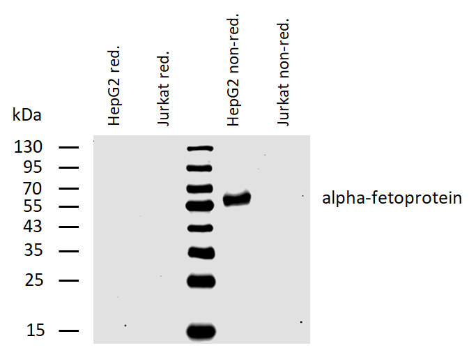 Alpha 1 Fetoprotein antibody