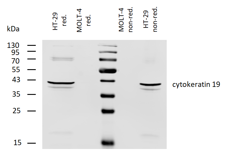 Cytokeratin 19 antibody (Biotin)