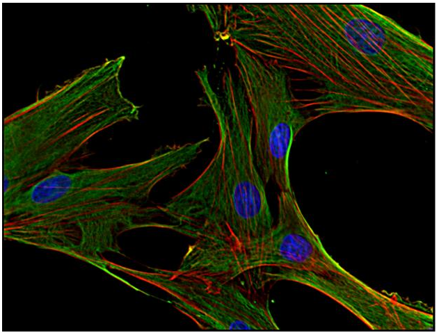 Clathrin (H chain) antibody