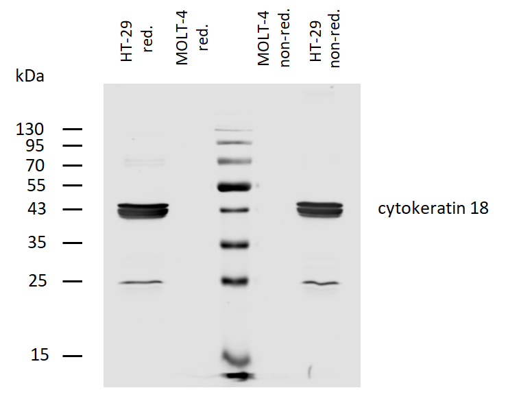 Cytokeratin 18 antibody (Biotin)