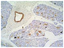 Cytokeratin 7/17 antibody