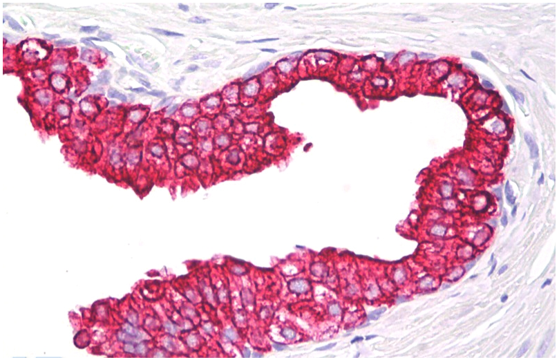 Cytokeratin 5/18 antibody