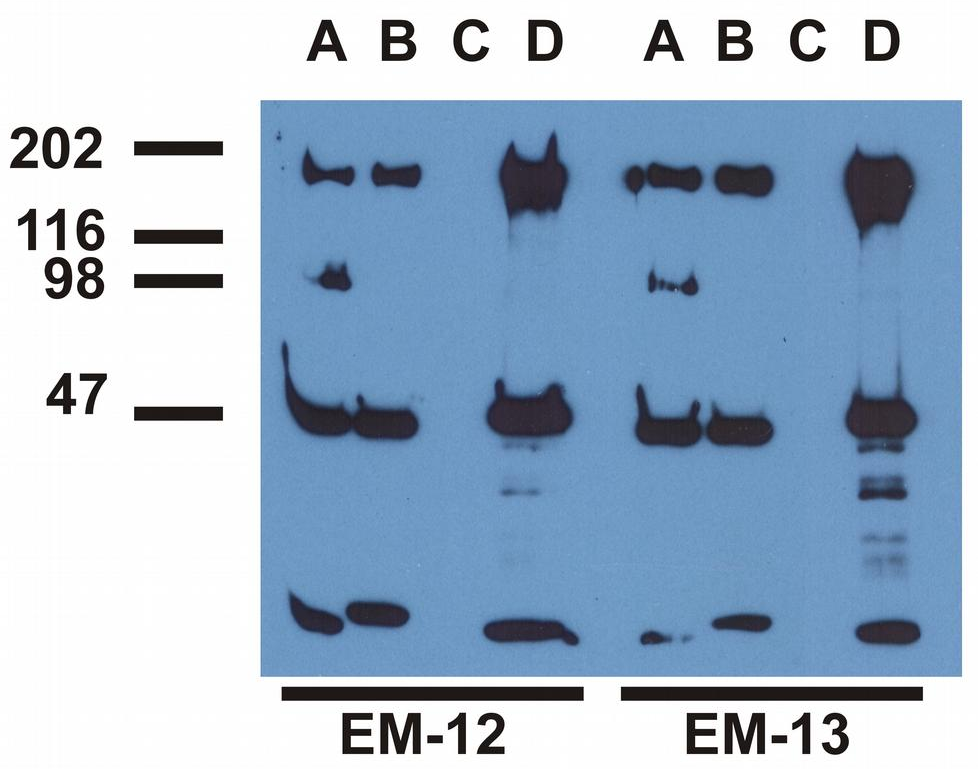Anti-Hu EGFR (pY992) Purified