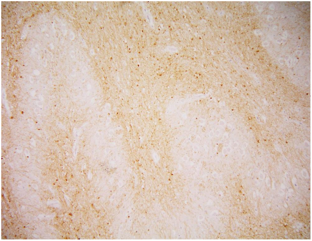 Anti-PSMA Purified