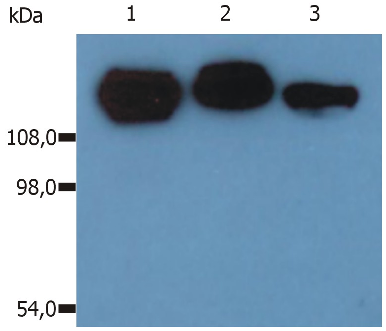 Integrin beta 1 antibody