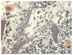 Anti-HLA-G Purified