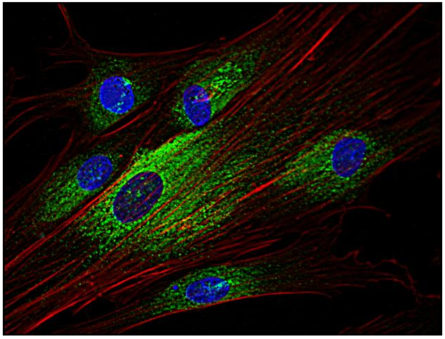 Syk antibody