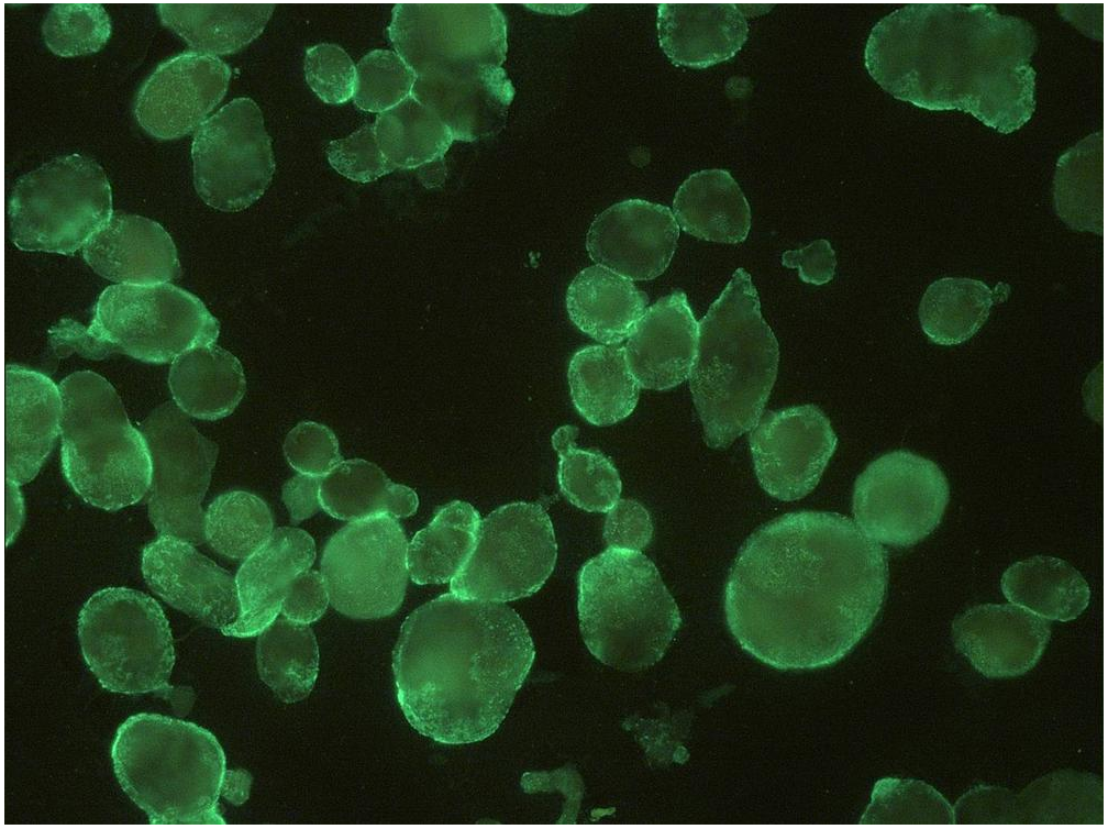 HSV1 + HSV2 antibody