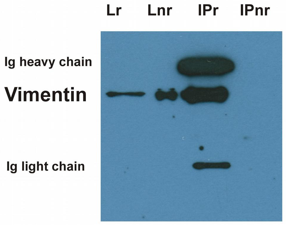 Anti-Vimentin Purified