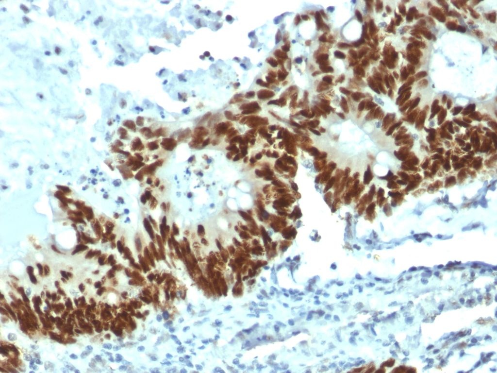 Mouse anti P53 (TP53 tumor suppressor protein)