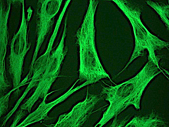 Recombinant mouse anti vimentin