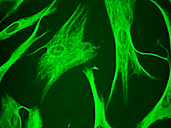 Recombinant rabbit anti vimentin