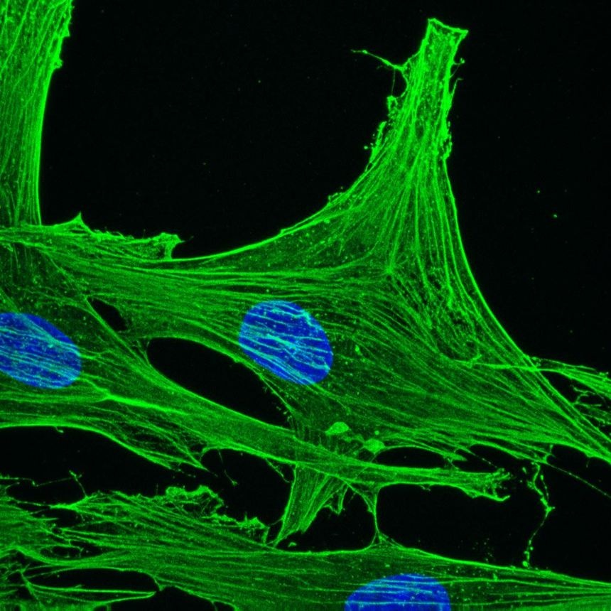 Mouse anti actin gamma-cytoplasmic