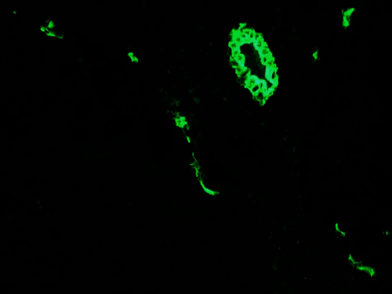 Mouse anti Cytokeratin 7 / Keratin K7