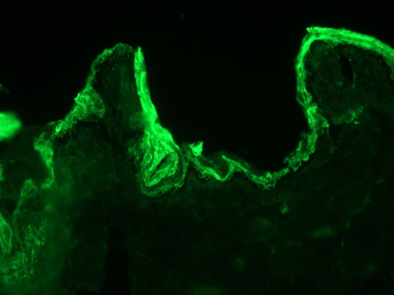 Mouse anti Cytokeratin 10 / Keratin K10