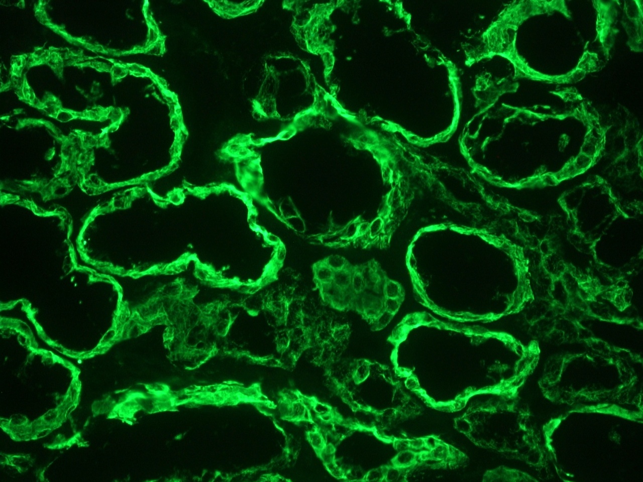 Mouse anti Cytokeratin 18 / Keratin K18
