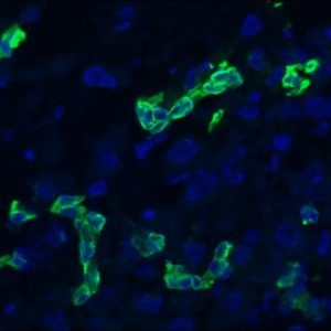 Mouse anti Cytokeratin 19 / Keratin K19