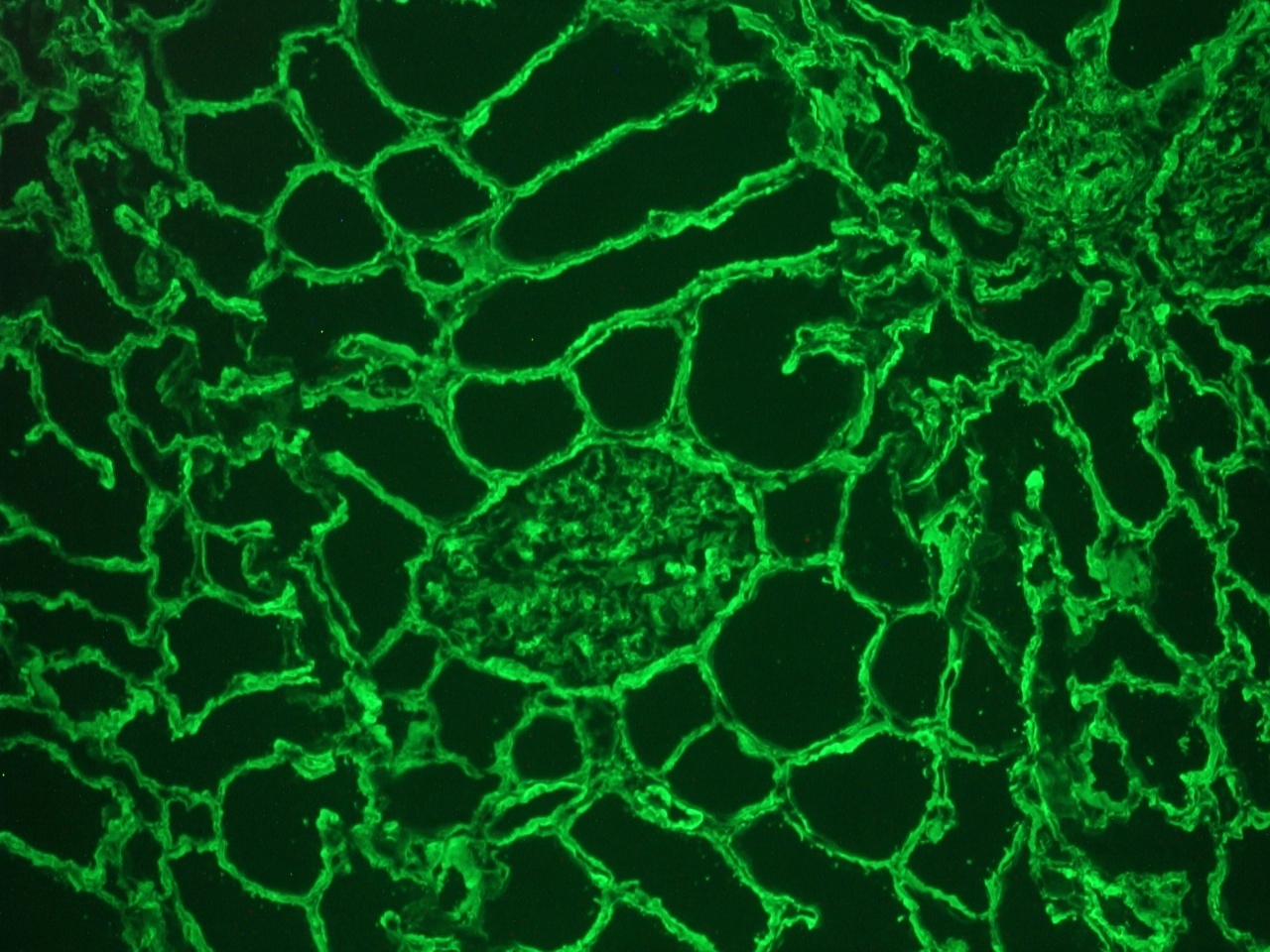 Collagen IV antibody