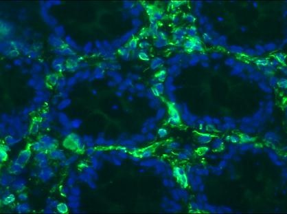 Mouse anti Vimentin