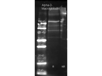 Alpha-2-Macroglobulin Antibody Peroxidase Conjugated