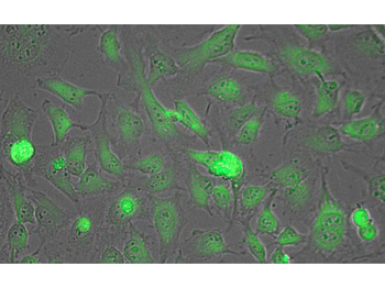 Lactate Dehydrogenase Antibody Peroxidase Conjugated