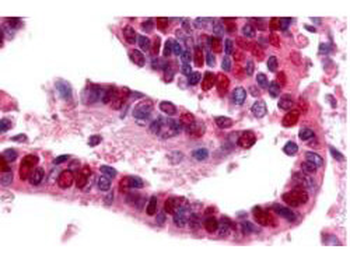 Ubiquitin Activating Enzyme E1 Antibody