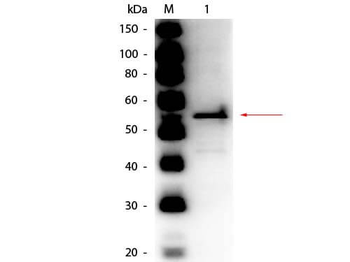 Aldehyde Dehydrogenase Antibody Peroxidase Conjugated
