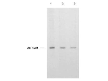 Thymidylate Synthase Antibody