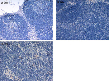 IL-6 Antibody