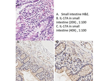 IL-17A Antibody