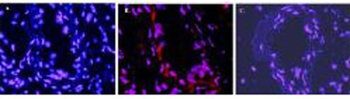 IL-1 Beta Antibody