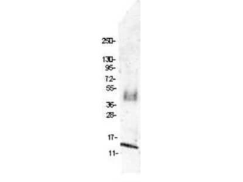 MIP-1 beta Antibody