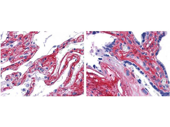 Collagen Type V Antibody