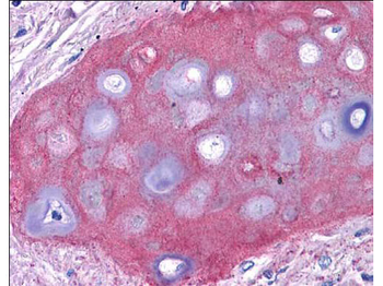 Collagen Type II Antibody Peroxidase Conjugated