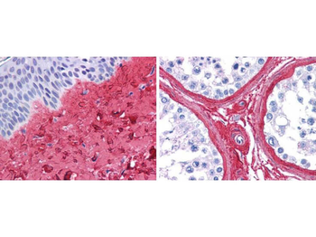Collagen Type III Antibody Biotin Conjugated