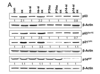 HRP Western Blot Rabbit IgG antibody (Peroxidase)