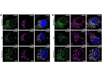 Human Transferrin protein (TRITC)