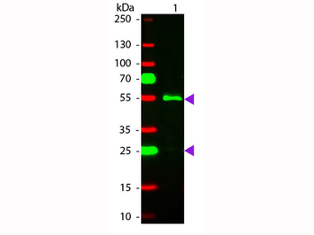 Human IgG (gamma chain) Antibody Rhodamine Conjugated
