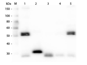 Rat IgG (H&L) Antibody Rhodamine Conjugated