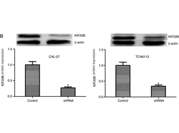 F(ab')2 Rabbit IgG (H&L) Antibody Pre-Adsorbed