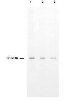 Thymidylate Synthase Antibody