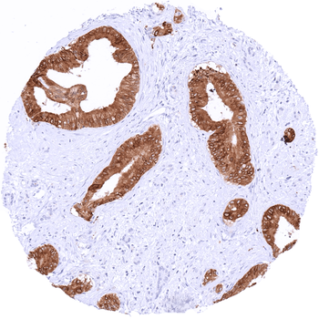 TFF1 / pS2 antibody (MSVA-482M)