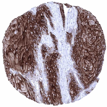 Desmoglein 1 antibody (MSVA-544M)