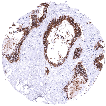 Cadherin 17 / CDH17 antibody (MSVA-517M)