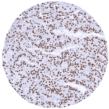 Transcription factor E3 / TFE3 antibody (MSVA-403R)