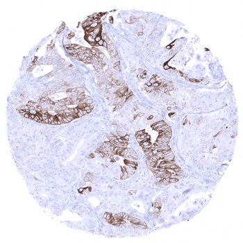Cytokeratin 6 antibody (MSVA-606R)