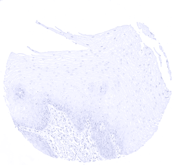Cytokeratin 10 antibody (MSVA-610M)