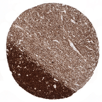 NSE gamma antibody (MSVA-451M)