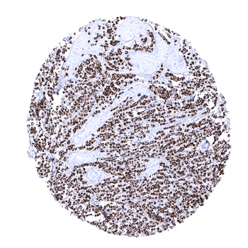 Cytokeratin, Pan antibody (MSVA-000R)