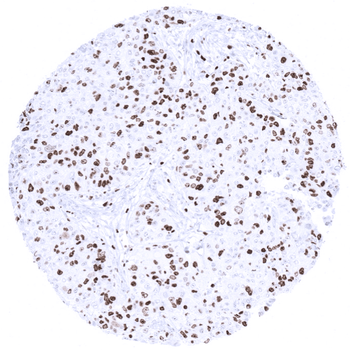 Ki-67 antibody (MSVA-267M)